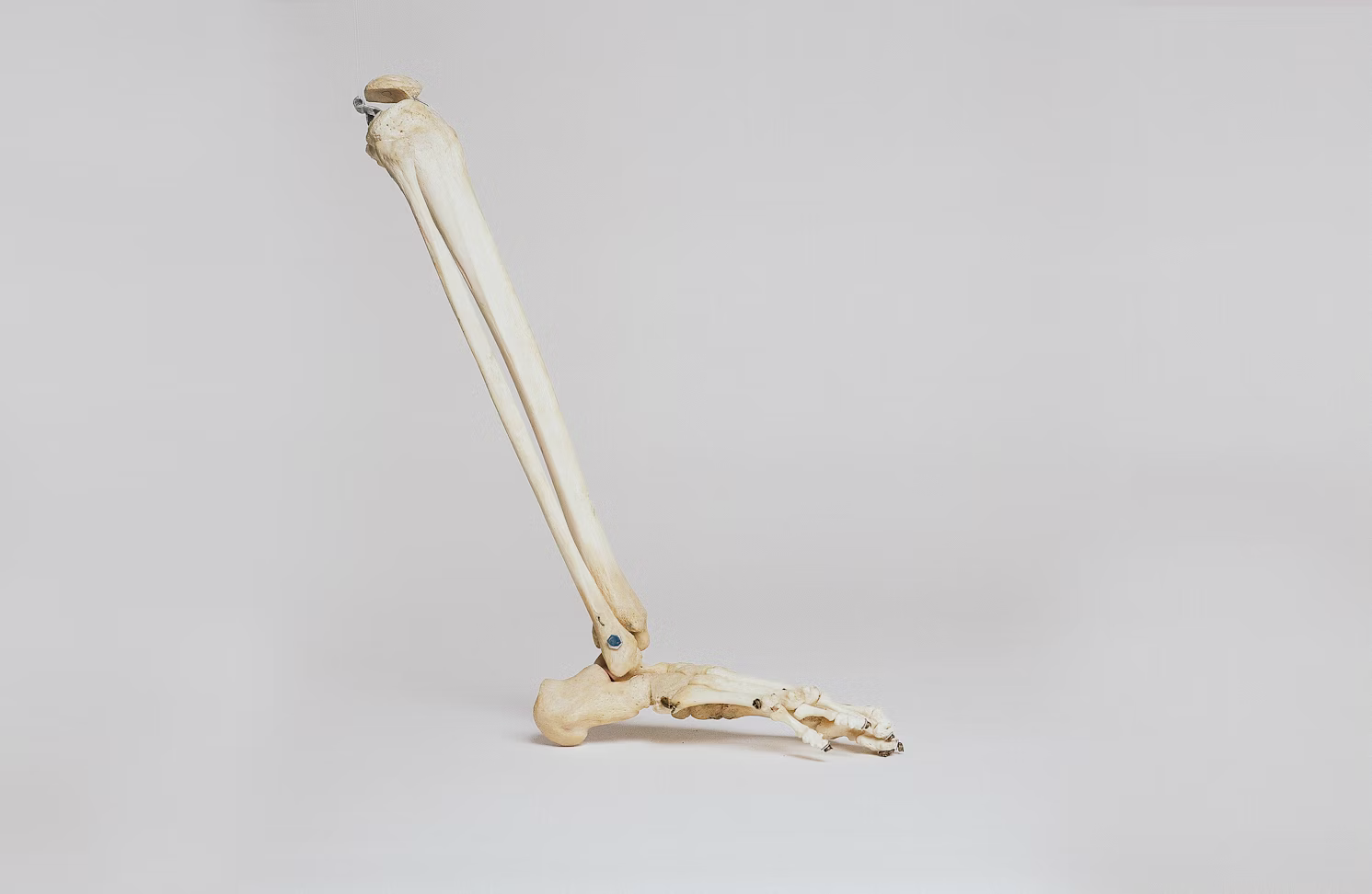 A 3D model of the bones in the lower leg.