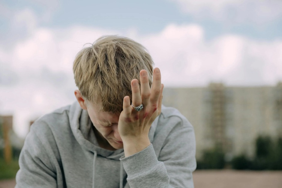 A young man holds his head in pain.